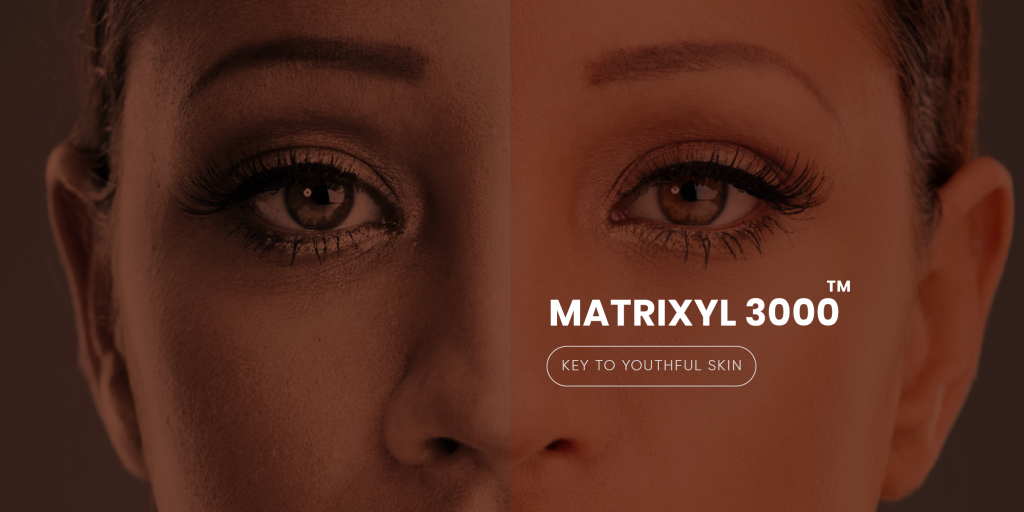 Matrix 3000 Sereneaura